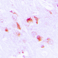 APOL2 / Apolipoprotein L 2 Antibody - Immunohistochemical analysis of Apolipoprotein L2 staining in human brain formalin fixed paraffin embedded tissue section. The section was pre-treated using heat mediated antigen retrieval with sodium citrate buffer (pH 6.0). The section was then incubated with the antibody at room temperature and detected using an HRP conjugated compact polymer system. DAB was used as the chromogen. The section was then counterstained with hematoxylin and mounted with DPX.