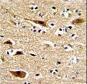 APP / Beta Amyloid Precursor Antibody - Formalin-fixed and paraffin-embedded human brain with APP Antibody , which was peroxidase-conjugated to the secondary antibody, followed by DAB staining. This data demonstrates the use of this antibody for immunohistochemistry; clinical relevance has not been evaluated.