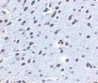 APP / Beta Amyloid Precursor Antibody - Immunohistochemistry of APP in mouse brain tissue with APP antibody at 2.5 ug/ml.