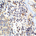 APP / Beta Amyloid Precursor Antibody - Immunohistochemistry of APP in human brain tissue with APP antibody at 2.5 µg/ml.