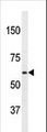 APPBP2 Antibody - Western blot of anti-PAT1(APPBP2) Antibody in HL60 cell line lysates (35 ug/lane). PAT1(arrow) was detected using the purified antibody.