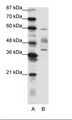 Aprataxin / APTX Antibody - A: Marker, B: NCI-H226 Cell Lysate.  This image was taken for the unconjugated form of this product. Other forms have not been tested.