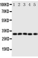 AQP9 / Aquaporin 9 Antibody - Anti-Aquaporin 9 antibody, Western blotting All lanes: Anti Aquaporin 9 at 0.5ug/ml Lane 1: Mouse Liver Tissue Lysate at 50ug Lane 2: Mouse Lung Tissue Lysate at 50ug Lane 3: Mouse Spleen Tissue Lysate at 50ug Lane 4: Mouse Testis Tissue Lysate at 50ug Lane 5: PC-12 Whole Cell Lysate at 40ug Predicted bind size: 31KD Observed bind size: 31KD