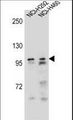 AR / Androgen Receptor Antibody - AR Antibody western blot of NCI-H292,NCI-H460 cell line lysates (35 ug/lane). The AR antibody detected the AR protein (arrow).