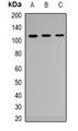 AR / Androgen Receptor Antibody - Western blot analysis of Androgen Receptor expression in HEK293T (A); NIH3T3 (B); mouse liver (C) whole cell lysates.