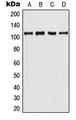 AR / Androgen Receptor Antibody - Western blot analysis of Androgen Receptor (pY363) expression in LNCaP (A); MCF7 UV-treated (B); mouse spleen (C); rat spleen (D) whole cell lysates.