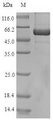 AUR1 Protein - (Tris-Glycine gel) Discontinuous SDS-PAGE (reduced) with 5% enrichment gel and 15% separation gel.