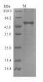 DME Protein - (Tris-Glycine gel) Discontinuous SDS-PAGE (reduced) with 5% enrichment gel and 15% separation gel.