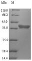 HDT2 Protein - (Tris-Glycine gel) Discontinuous SDS-PAGE (reduced) with 5% enrichment gel and 15% separation gel.