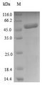 PCMP-H63 Protein - (Tris-Glycine gel) Discontinuous SDS-PAGE (reduced) with 5% enrichment gel and 15% separation gel.
