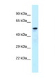 ARFGAP3 Antibody - ARFGAP3 antibody Western blot of Fetal Lung lysate. Antibody concentration 1 ug/ml.  This image was taken for the unconjugated form of this product. Other forms have not been tested.