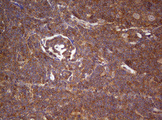 ARFL3 / ARL3 Antibody - IHC of paraffin-embedded Human lymphoma tissue using anti-ARL3 mouse monoclonal antibody. (Heat-induced epitope retrieval by 10mM citric buffer, pH6.0, 120°C for 3min).