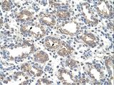 ARG1 / Arginase 1 Antibody - ARG1 / Liver Arginase antibody ARG1(arginase, liver) Antibody was used in IHC to stain formalin-fixed, paraffin-embedded human lung.  This image was taken for the unconjugated form of this product. Other forms have not been tested.