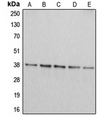 ARG2 / Arginase 2 Antibody - Western blot analysis of Arginase 2 expression in Jurkat (A); HepG2 (B); HEK293T (C); A549 (D); PC12 (E) whole cell lysates.