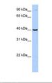 ARG2 / Arginase 2 Antibody - Jurkat cell lysate. Antibody concentration: 1.0 ug/ml. Gel concentration: 12%.  This image was taken for the unconjugated form of this product. Other forms have not been tested.