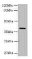 ARG2 / Arginase 2 Antibody - Western blot All lanes: Arg2 antibody at 10µg/ml + Jurkat whole cell lysate Secondary Goat polyclonal to rabbit IgG at 1/10000 dilution Predicted band size: 39 kDa Observed band size: 39 kDa