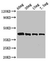 Arginine esterase Antibody - Western Blot Positive WB detected in Recombinant protein All lanes: Arginine antibody at 3µg/ml Secondary Goat polyclonal to rabbit IgG at 1/50000 dilution predicted band size: 42 kDa observed band size: 42 kDa