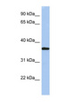 ARH / LDLRAP1 Antibody - LDLRAP1 antibody Western blot of HepG2 cell lysate. This image was taken for the unconjugated form of this product. Other forms have not been tested.