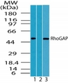 ARHGAP1 / CDC42GAP Antibody - Western blot of human RhoGAP1 in HeLa cell lysate in the 1) absence, 2) presence of immunizing peptide and 3) Raw cell lysate using antibody at 0.5 ug/ml.