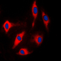 ARHGAP17 / NADRIN Antibody - Immunofluorescent analysis of ARHGAP17 staining in Lovo cells. Formalin-fixed cells were permeabilized with 0.1% Triton X-100 in TBS for 5-10 minutes and blocked with 3% BSA-PBS for 30 minutes at room temperature. Cells were probed with the primary antibody in 3% BSA-PBS and incubated overnight at 4 C in a humidified chamber. Cells were washed with PBST and incubated with a DyLight 594-conjugated secondary antibody (red) in PBS at room temperature in the dark. DAPI was used to stain the cell nuclei (blue).