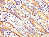 ARHGAP18 Antibody - Immunohistochemistry image at a dilution of 1:200 and staining in paraffin-embedded human small intestine tissue performed on a Leica BondTM system. After dewaxing and hydration, antigen retrieval was mediated by high pressure in a citrate buffer (pH 6.0) . Section was blocked with 10% normal goat serum 30min at RT. Then primary antibody (1% BSA) was incubated at 4 °C overnight. The primary is detected by a biotinylated secondary antibody and visualized using an HRP conjugated SP system.
