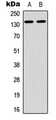 ARHGAP20 Antibody - Western blot analysis of ARHGAP20 expression in A549 (A); PC12 (B) whole cell lysates.