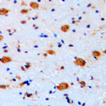 ARHGAP22 / RhoGAP2 Antibody - Immunohistochemical analysis of ARHGAP22 staining in human brain formalin fixed paraffin embedded tissue section. The section was pre-treated using heat mediated antigen retrieval with sodium citrate buffer (pH 6.0). The section was then incubated with the antibody at room temperature and detected using an HRP conjugated compact polymer system. DAB was used as the chromogen. The section was then counterstained with hematoxylin and mounted with DPX.