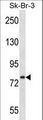 ARHGAP24 Antibody - ARHGAP24 Antibody western blot of SK-BR-3 cell line lysates (35 ug/lane). The ARHGAP24 antibody detected the ARHGAP24 protein (arrow).