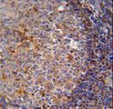 ARHGAP25 Antibody - ARHGAP25 Antibody immunohistochemistry of formalin-fixed and paraffin-embedded human tonsil tissue followed by peroxidase-conjugated secondary antibody and DAB staining.