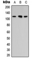 ARHGAP30 Antibody - Western blot analysis of ARHGAP30 expression in MCF7 (A); Raw264.7 (B); PC12 (C) whole cell lysates.
