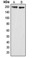 ARHGAP35 / GRLF1 Antibody - Western blot analysis of GRLF1 (pY1087) expression in HeLa (A); mouse brain (B) whole cell lysates.