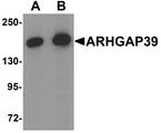 ARHGAP39 Antibody - Western blot analysis of ARHGAP39 in A20 cell lysate with ARHGAP39 antibody at (A) 1 and (B) 2 ug/ml