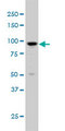 ARHGAP6 Antibody - ARHGAP6 monoclonal antibody (M01), clone 6B3 Western Blot analysis of ARHGAP6 expression in K-562.