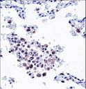 ARHGDIB / D4 GDI Antibody - ARHGDIB Antibody immunohistochemistry of formalin-fixed and paraffin-embedded human lung tissue followed by peroxidase-conjugated secondary antibody and DAB staining.