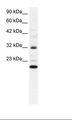 ARHGDIG / RHOGDI-3 Antibody - Daudi Cell Lysate.  This image was taken for the unconjugated form of this product. Other forms have not been tested.