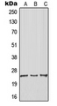 ARHGDIG / RHOGDI-3 Antibody - Western blot analysis of RhoGDI gamma expression in Jurkat (A); MCF7 (B); Raw264.7 (C) whole cell lysates.