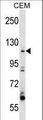 ARHGEF1 Antibody - ARHGEF1 Antibody western blot of CEM cell line lysates (35 ug/lane). The ARHGEF1 antibody detected the ARHGEF1 protein (arrow).