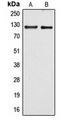 ARHGEF1 Antibody - Western blot analysis of ARHGEF1 expression in HUVEC (A); Raw264.7 (B) whole cell lysates.