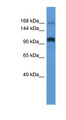 ARHGEF2 / GEF-H1 Antibody - ARHGEF2 / GEF-H1 antibody Western blot of Placenta lysate.  This image was taken for the unconjugated form of this product. Other forms have not been tested.