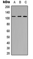 ARHGEF2 / GEF-H1 Antibody - Western blot analysis of GEF H1 expression in HeLa (A); Jurkat (B); NIH3T3 (C) whole cell lysates.