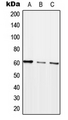 ARHGEF5 Antibody - Western blot analysis of ARHGEF5 expression in HEK293T (A); SP2/0 (B); H9C2 (C) whole cell lysates.