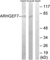 ARHGEF7 Antibody - Western blot analysis of lysates from rat muscle and rat heart cells, using ARHGEF7 Antibody. The lane on the right is blocked with the synthesized peptide.