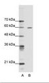 ARID3A / DRIL1 Antibody - A: Marker, B: HepG2 Cell Lysate.  This image was taken for the unconjugated form of this product. Other forms have not been tested.