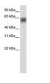 ARID3B Antibody - Fetal Thymus Lysate.  This image was taken for the unconjugated form of this product. Other forms have not been tested.