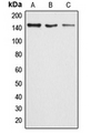 ARID4B Antibody - Western blot analysis of ARID4B expression in HeLa (A); MCF7 (B); rat lung (C) whole cell lysates.