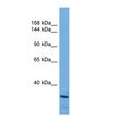ARID5B Antibody - Western blot of Human HepG2. ARID5B antibody dilution 1.0 ug/ml.  This image was taken for the unconjugated form of this product. Other forms have not been tested.