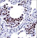 ARIH2 Antibody - ARIH2 Antibody immunohistochemistry of formalin-fixed and paraffin-embedded human lung tissue followed by peroxidase-conjugated secondary antibody and DAB staining.