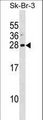 ARL1 Antibody - ARL1 Antibody western blot of SK-BR-3 cell line lysates (35 ug/lane). The ARL1 antibody detected the ARL1 protein (arrow).