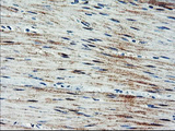 ARL11 Antibody - IHC of paraffin-embedded Human colon tissue using anti-ARL11 mouse monoclonal antibody.