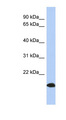 Antibody - ARL17B / ARL17 antibody Western blot of Placenta lysate. This image was taken for the unconjugated form of this product. Other forms have not been tested.